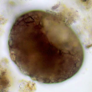 Cyclopyxis intermedia