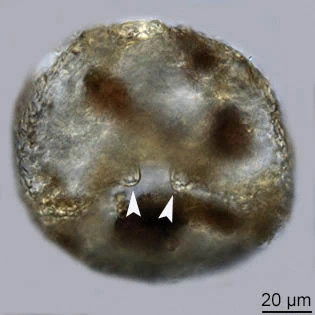 Cyclopyxis leidyi