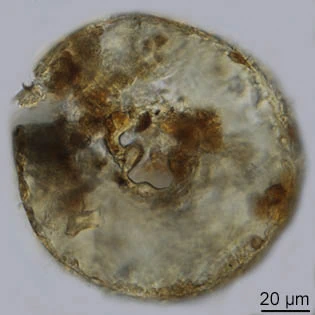 Cyclopyxis leidyi