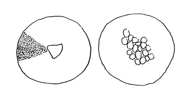 Cyclopyxis triangularistoma