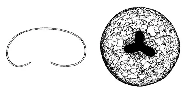 Cyclopyxis trilobata