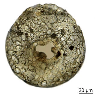 Cyclopyxis leidyi