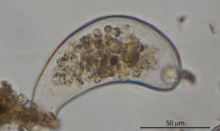 Cyphoderia spec.