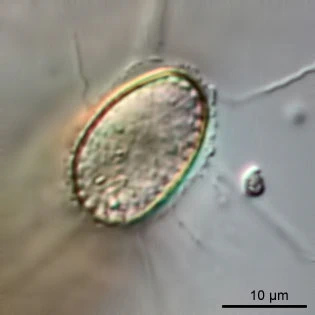 Cyphoderia ampulla