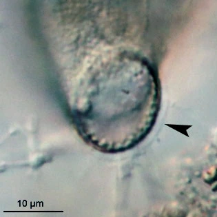 Cyphoderia ampulla