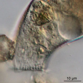 Cyphoderia ampulla
