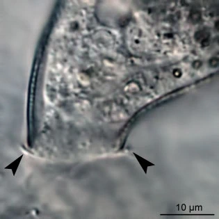 Cyphoderia ampulla