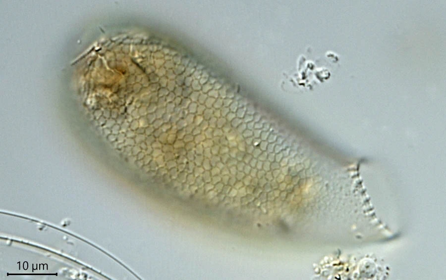 Cyphoderia