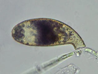 Cyphoderia ampulla
