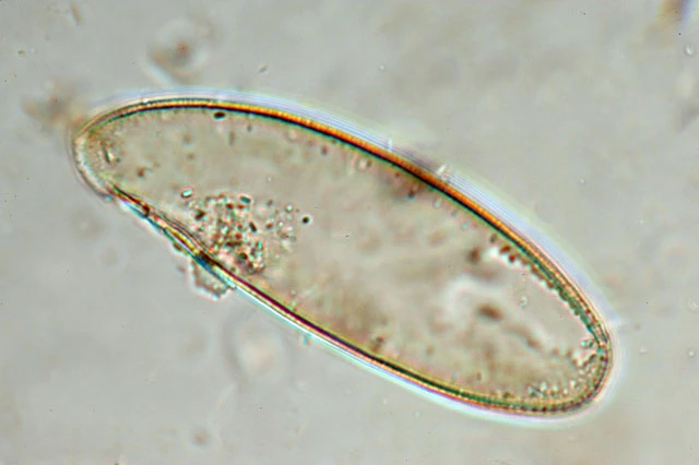Cyphoderia ampulla