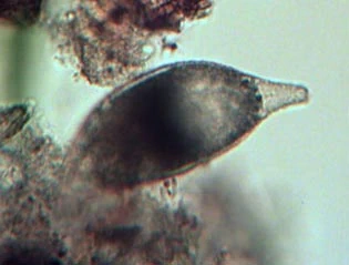 Cyphoderia ampulla