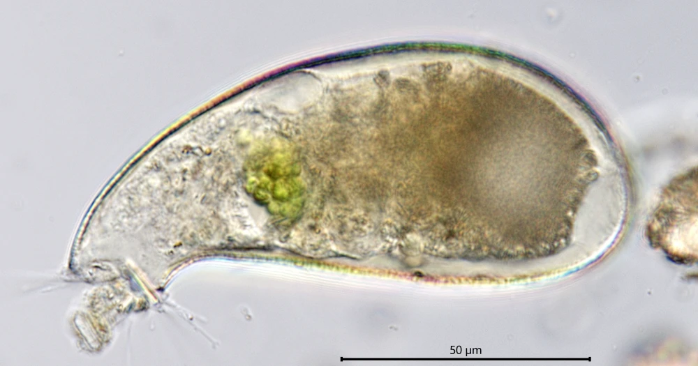 Cyphoderia ampulla