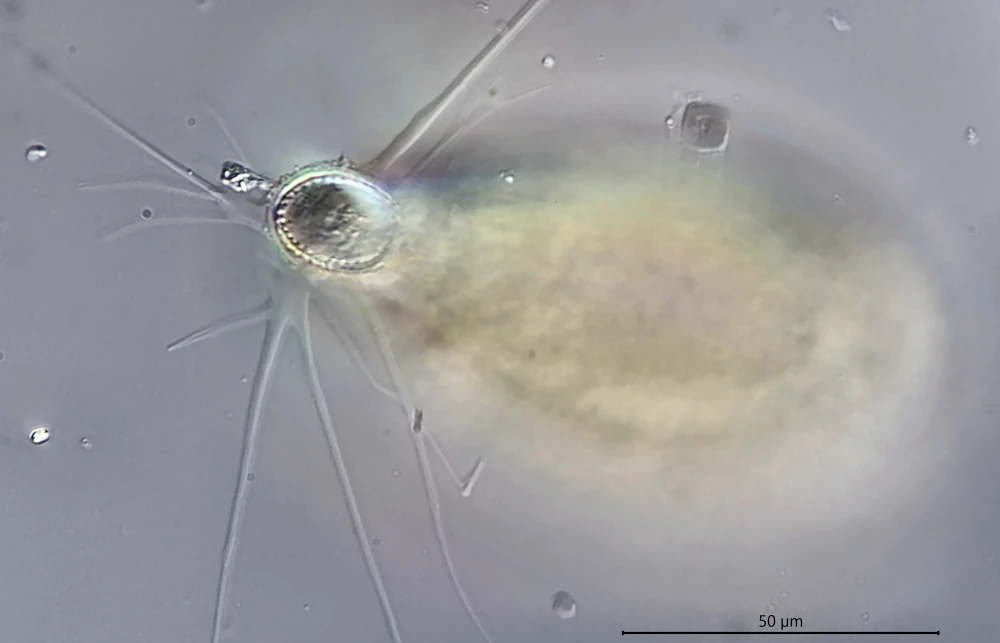 Cyphoderia ampulla