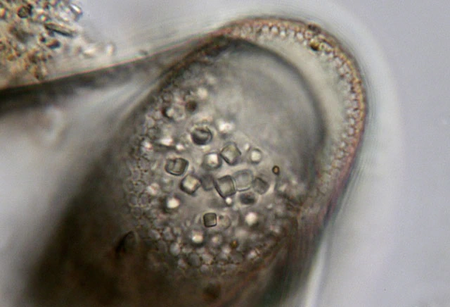 Cyphoderia spec.