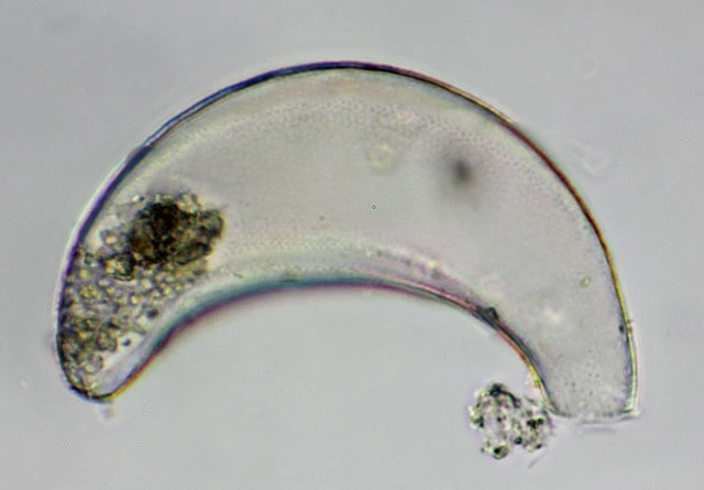 Cyphoderia spec.