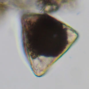 Cyphoderia calceolus