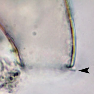 Cyphoderia spec.