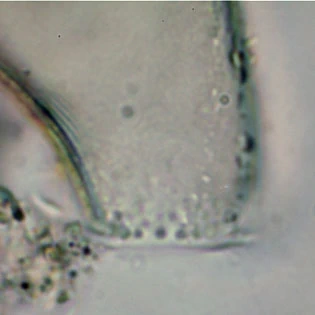 Cyphoderia spec.