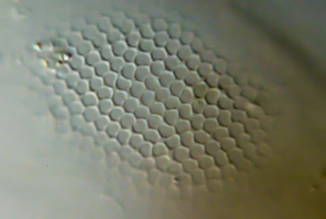 Cyphoderia spec.