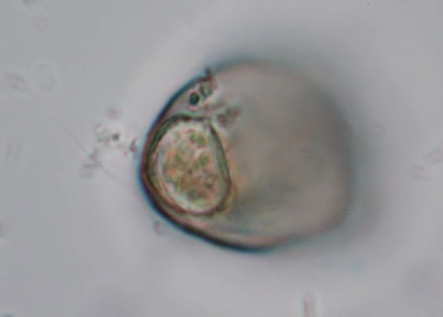 Cyphoderia laevis