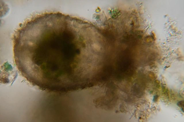 Difflugia binucleata
