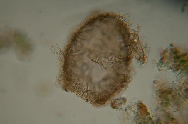Difflugia binucleata