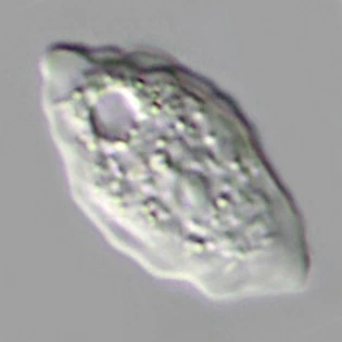 Paradermamoeba