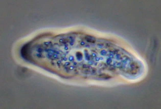 Paradermamoeba