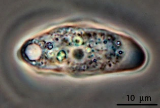 Paradermamoeba