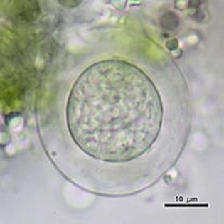 Difflugia difficilis.