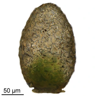 Difflugia labiosa