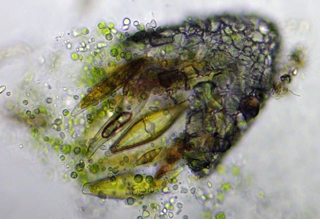 Difflugia labiosa