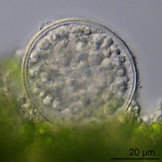 Difflugia labiosa
