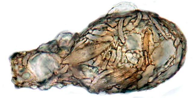 Difflugia bacillifera