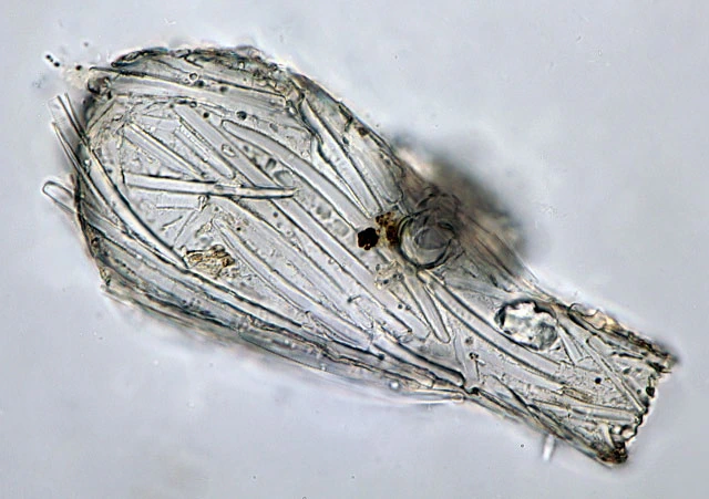 Difflugia bacillifera - Ferry Siemensma