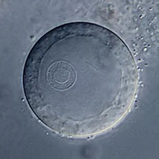 Erugomicula bidens nucleus