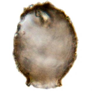 Difflugia binucleata