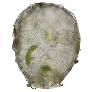 Difflugia binucleata
