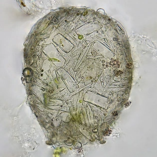 Difflugia binucleata