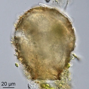 Difflugia binucleata