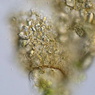 Difflugia binucleata