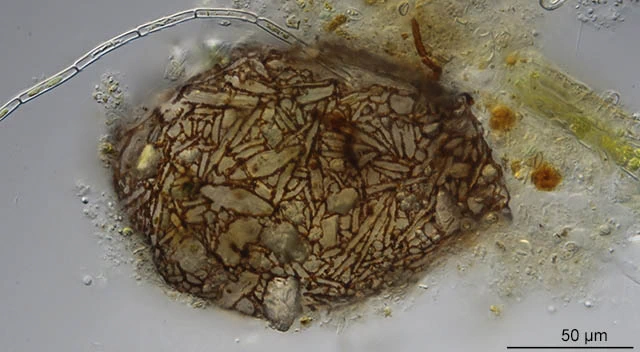 Difflugia binucleata
