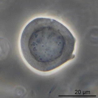 Difflugia binucleata nucleus