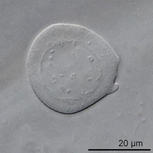 Difflugia binucleata nucleus