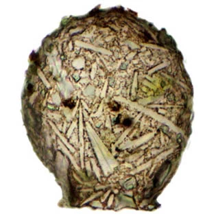 Difflugia binucleata