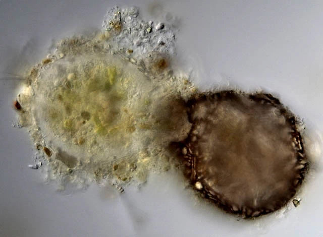 Difflugia binucleata