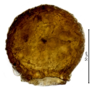 Difflugia brevicolla