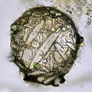 Difflugia brevicolla
