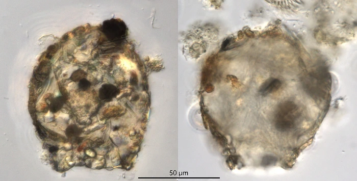 Difflugia brevicolla