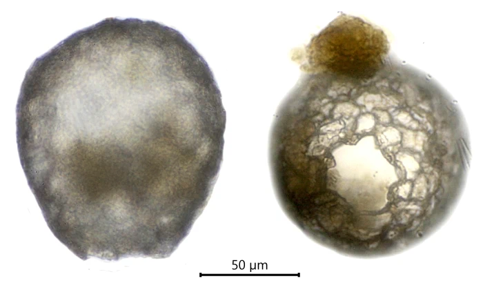 Difflugia chaquensis